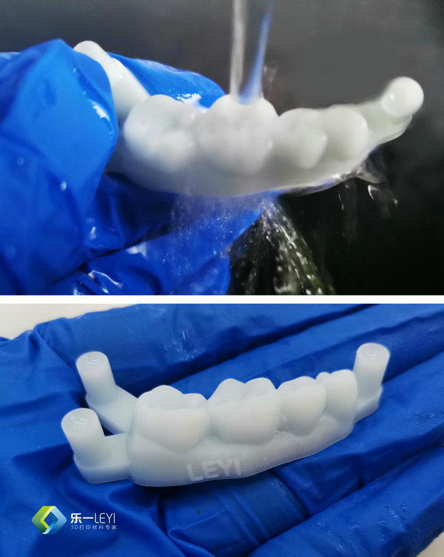 乐一齿科3d打印材料方案又一新突破水洗牙模材料正式上市